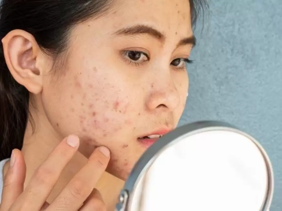 What are the disadvantages of ice on your face ?