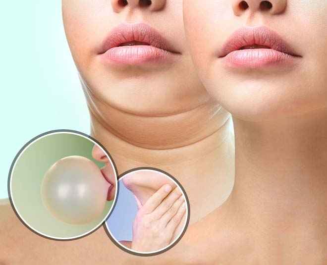 Can chewing gum reduce double chin?