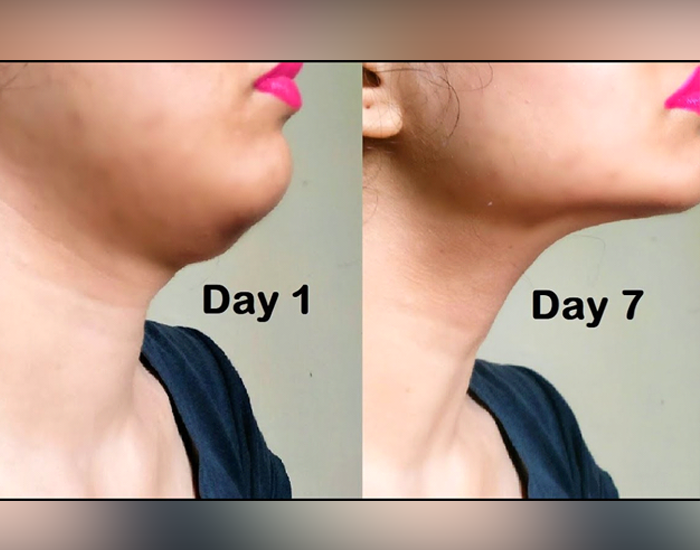 How to lose double chin
