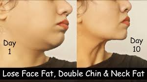 Can chin fat be lost?