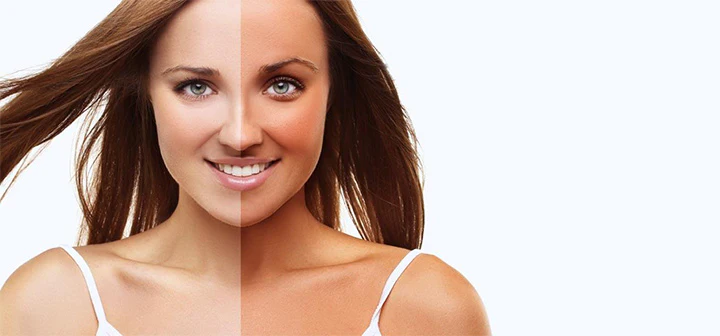 Can ice remove tan ?
